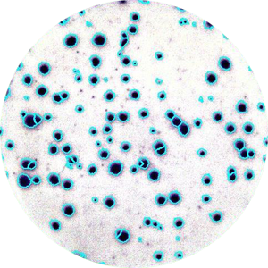 Application Elispot - Enzymatic single color