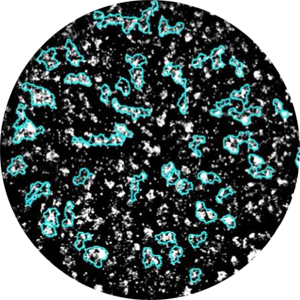 Application HCMV (Human cytomegalovirus): unstained