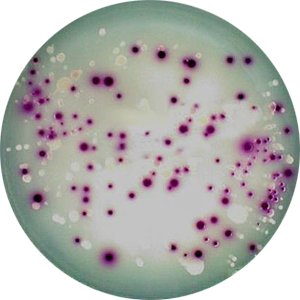 Application Various media/strain combinations on petridishes